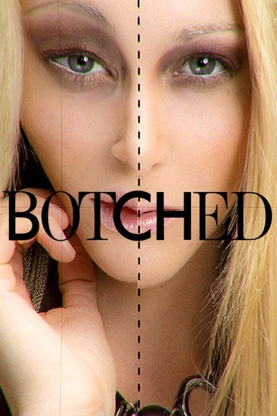 Botched - Season 6